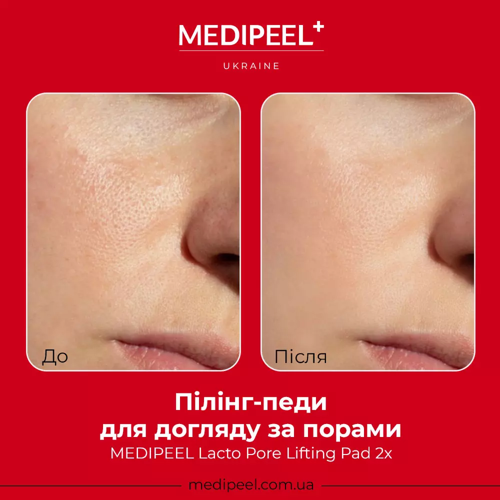 MEDIPEEL Lacto Pore Lifting Pad 2x