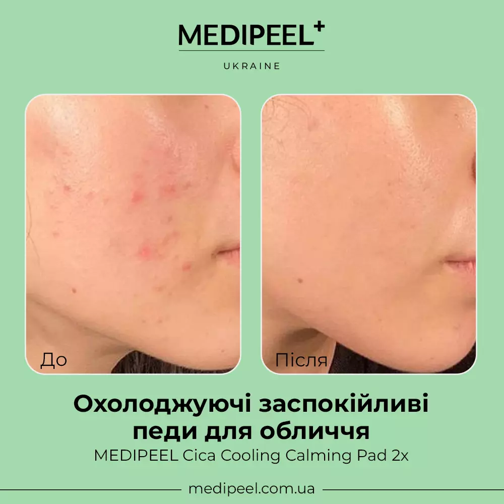 MEDIPEEL Cica Cooling Calming Pad 2x
