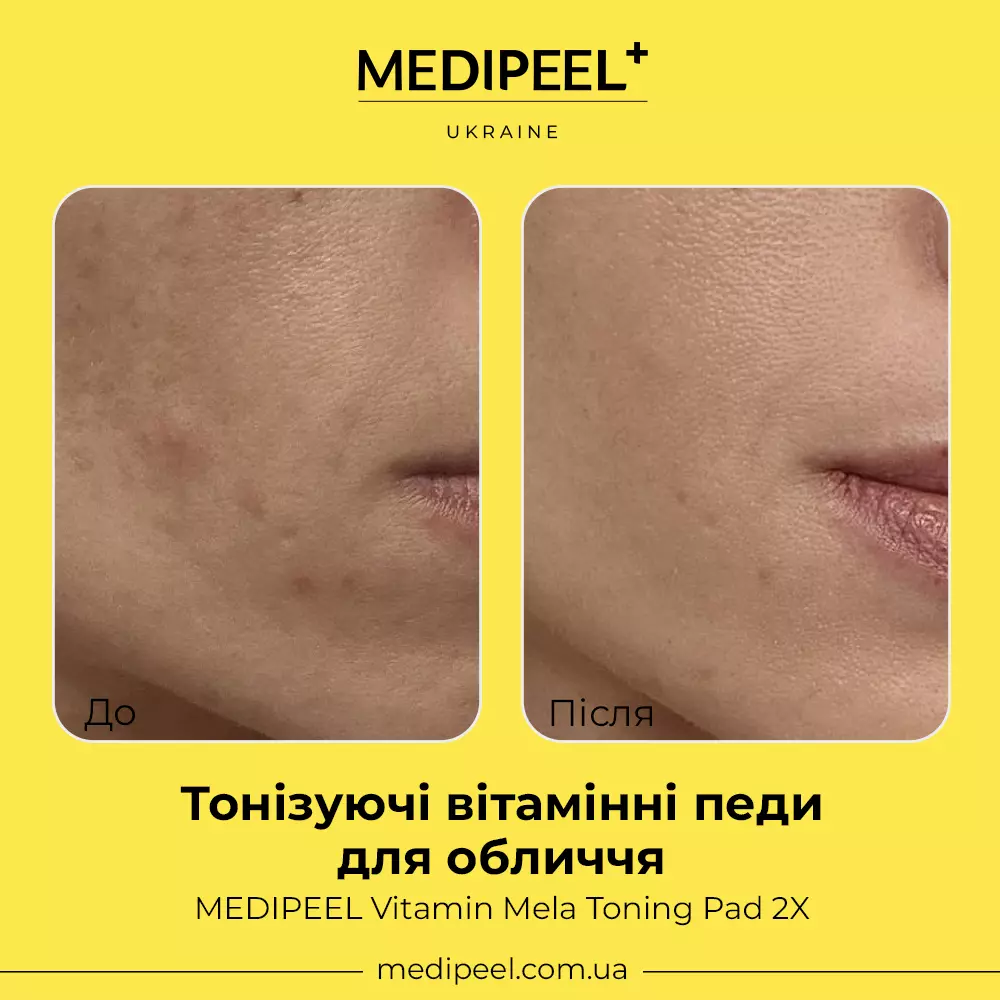 MEDIPEEL Vitamin Mela Toning Pad 2X