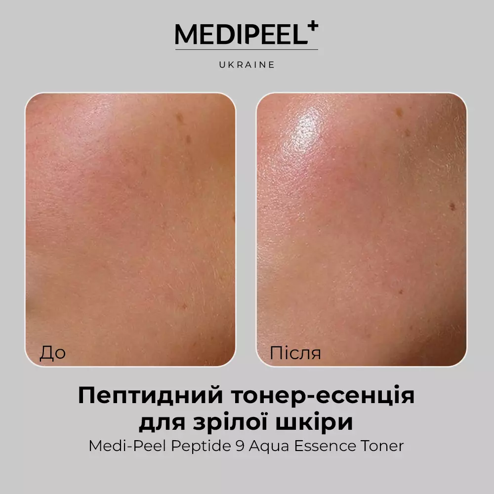 Купити Зволожуючий пептидний тонер-есенція для зрілої шкіри Medi Peel Peptide 9 Aqua Essence Toner