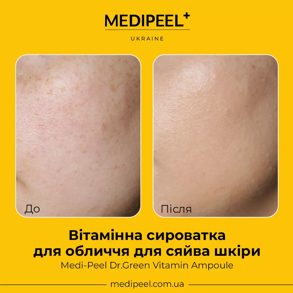 Купити Вітамінна сироватка для обличчя для сяйва шкіри Medi-Peel Dr.Green Vitamin Ampoule