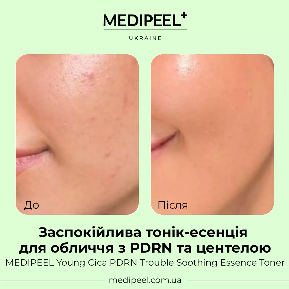 Young Cica PDRN Trouble Soothing Essence Toner