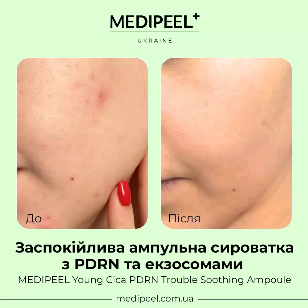 Young Cica PDRN Trouble Soothing Ampoule