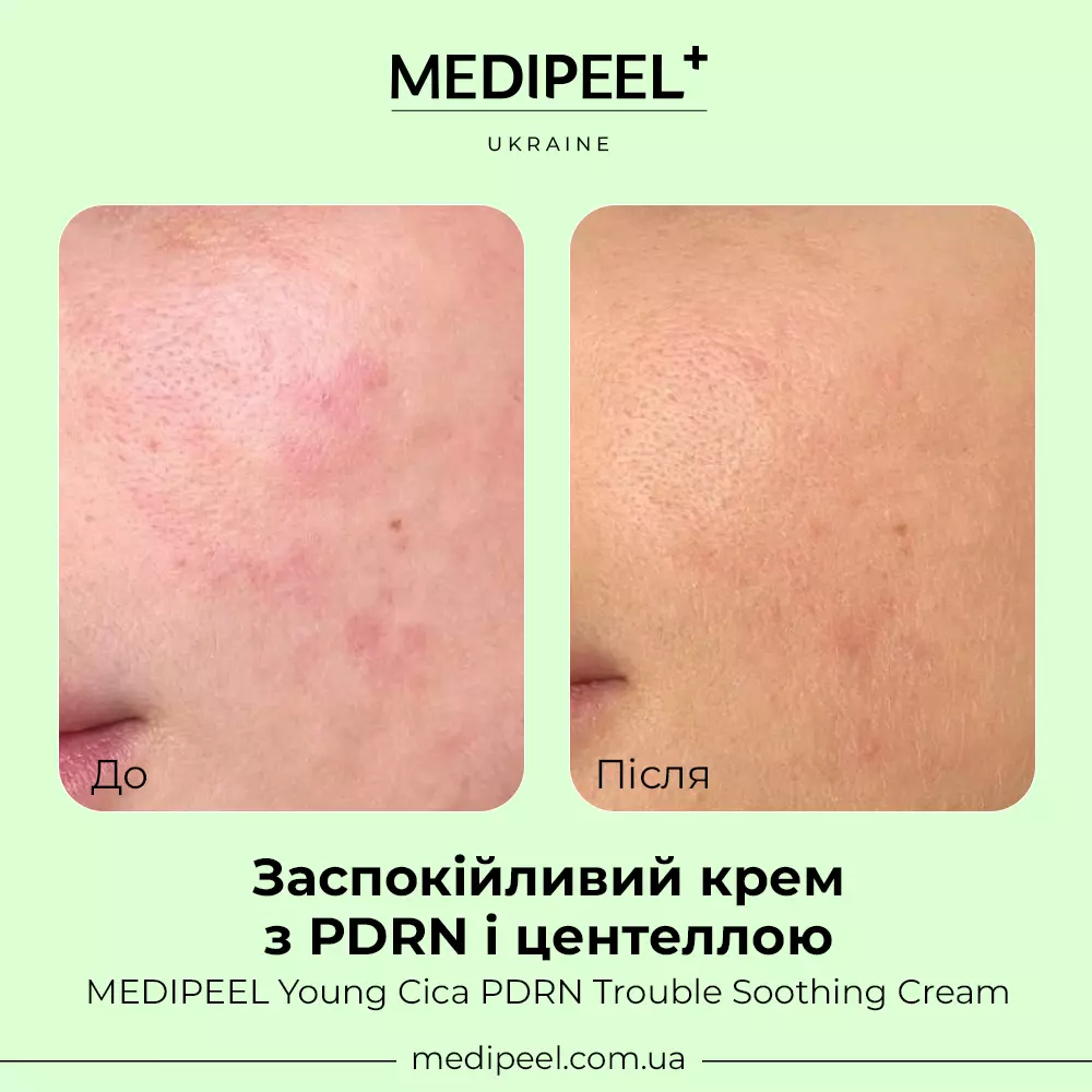 Young Cica PDRN Trouble Soothing Cream