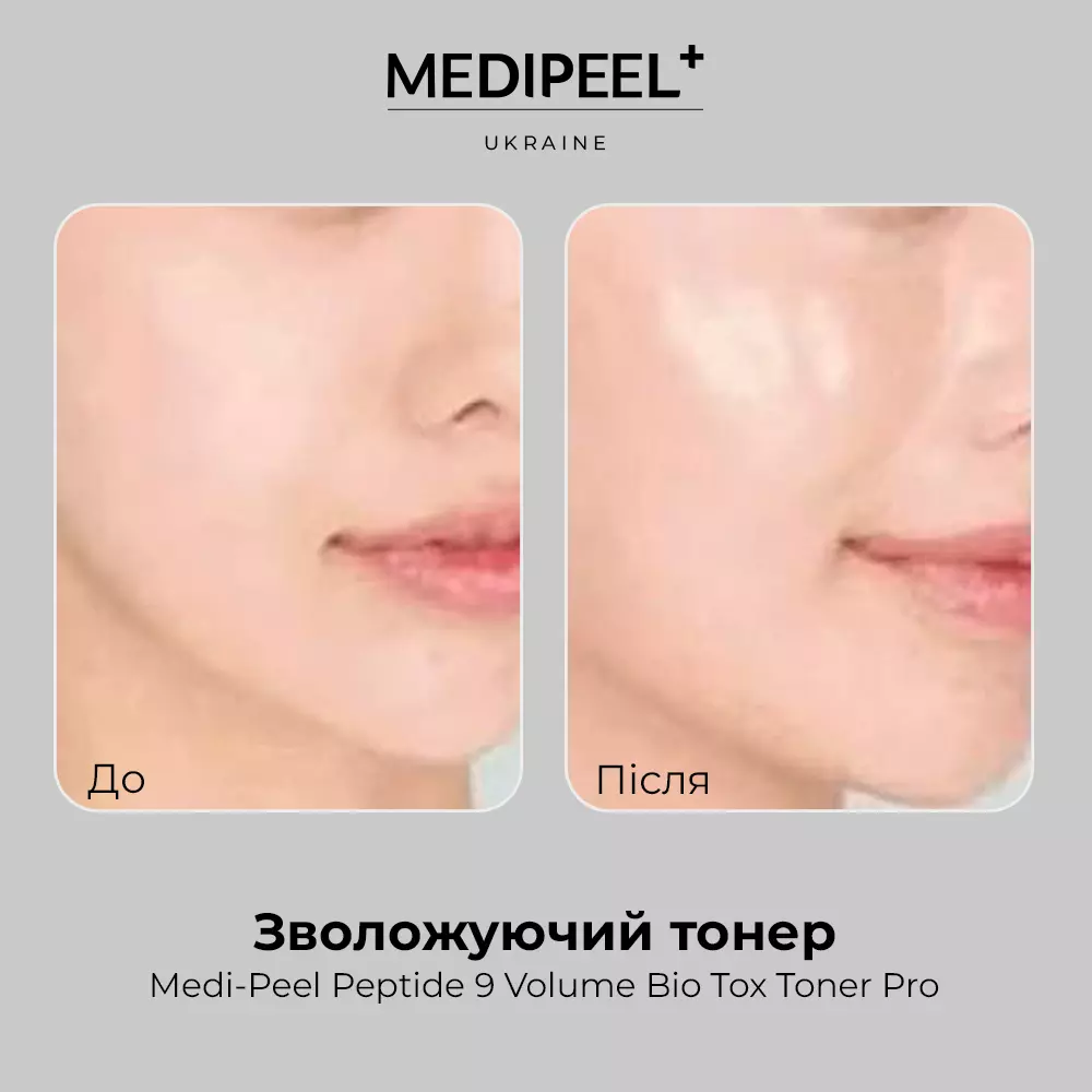 Medi-Peel Peptide 9 Volume Bio Tox Toner Pro: Увлажнение и Эластичность Кожи