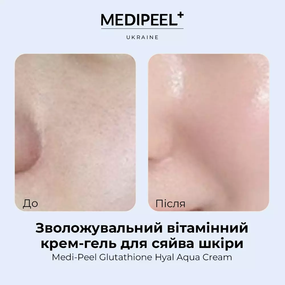 SESDERMA SALISES Крем-гель увлажняющий для кожи, склонной к акне 50мл, Испания