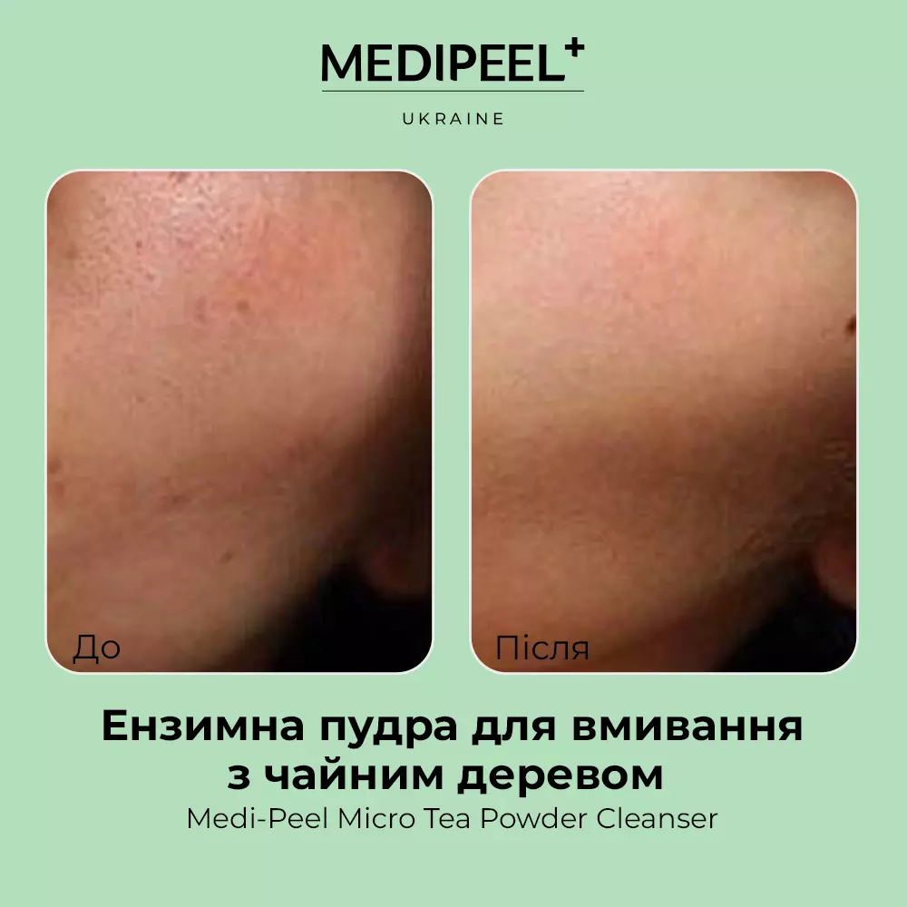 Купити Глибоко очищувальна ензимна пудра з чайним деревом Medi-Peel Micro Tea Powder Cleanser