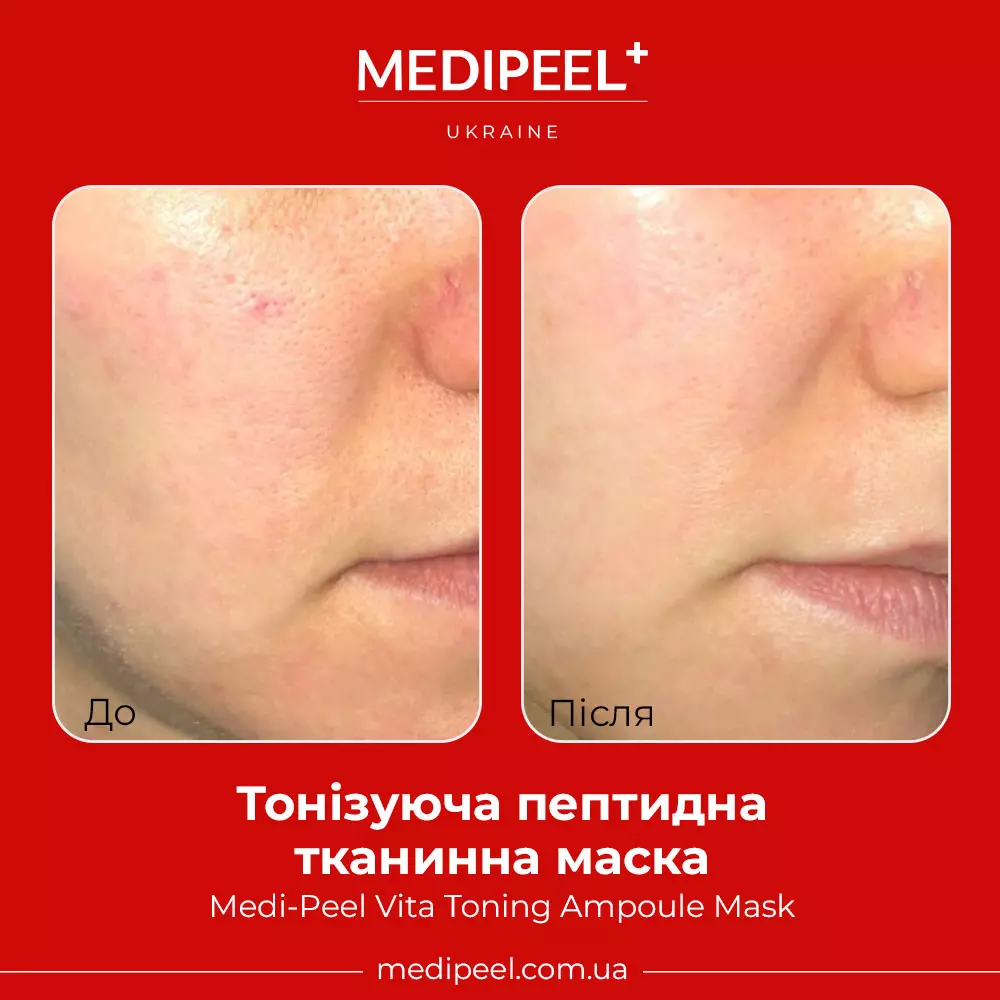 Medi-Peel Vita Toning Ampoule Mask - Преобразующая Тонизирующая Маска для  Лица