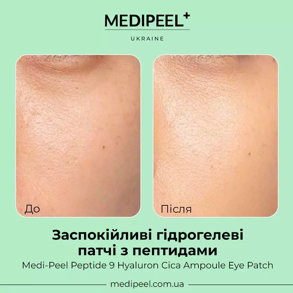 Заспокійливі гідрогелеві патчі з пептидами Medi Peel Peptide 9 Hyaluron Cica Ampoule Eye Patch в інтернет-магазині MEDI-PEEL - фото Купити Заспокійливі гідрогелеві патчі з пептидами Medi Peel Peptide 9 Hyaluron Cica Ampoule Eye Patch