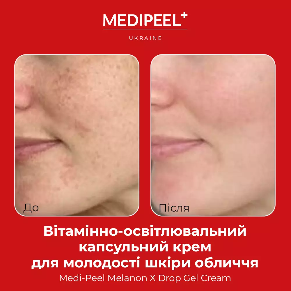 MEDIPEEL Melanon X Drop Gel Cream, 50 мл | Профессиональная косметика ...