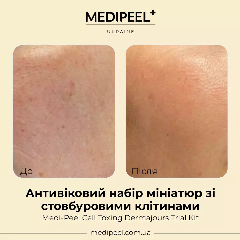 Антивозрастной набор миниатюр со стволовыми клетками Medi Peel Cell Toxing Dermajours Trial Kit в интернет-магазине MEDI-PEEL - фото Купить Антивозрастной набор миниатюр со стволовыми клетками Medi Peel Cell Toxing Dermajours Trial Kit