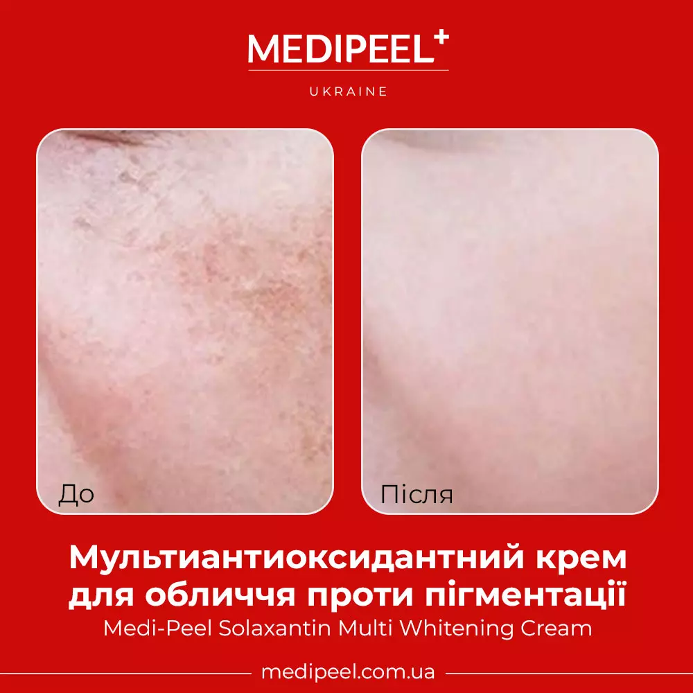 Антиоксидантный крем для лица против пигментации Medi-Peel Solaxantin Multi Whitening Cream в интернет-магазине MEDI-PEEL - фото Купить Антиоксидантный крем для лица против пигментации Medi-Peel Solaxantin Multi Whitening Cream