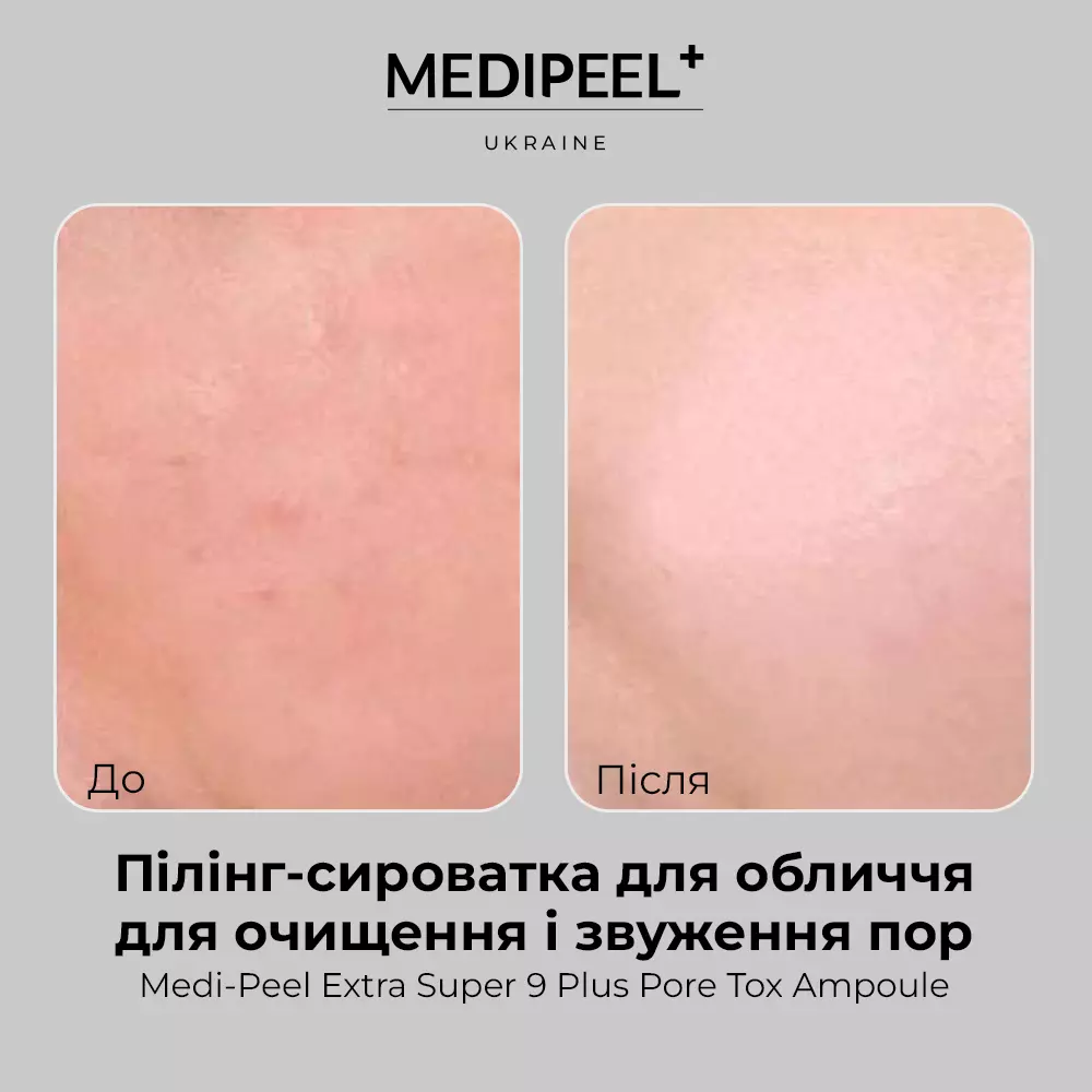 MEDIPEEL Extra Super 9 Plus Pore Tox Ampoule: Сыворотка для очищения пор
