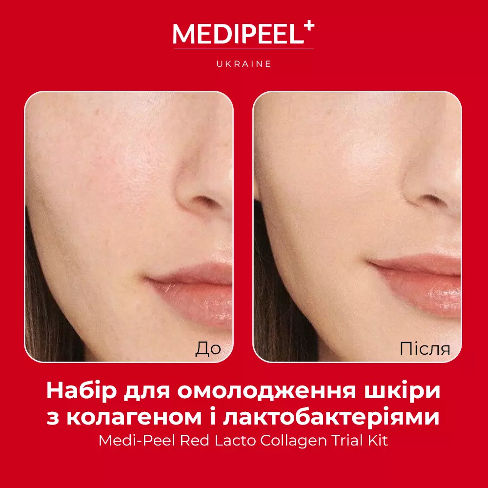 MEDIPEEL Red Lacto Collagen Trial Kit – Укрепление Кожи в Пути