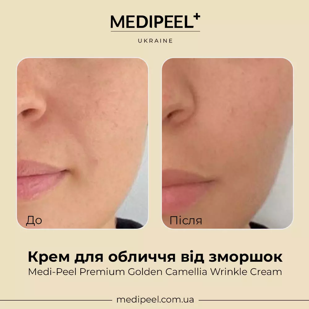 MEDI-PEEL - Golden Camellia Wrinkle Cream - Luxusní Protivráskový - Foto 9