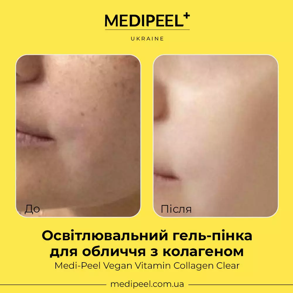 Купить Осветляющий гель-пенка для лица с коллагеном и облепихой Medi-Peel Vegan Vitamin Collagen Clear
