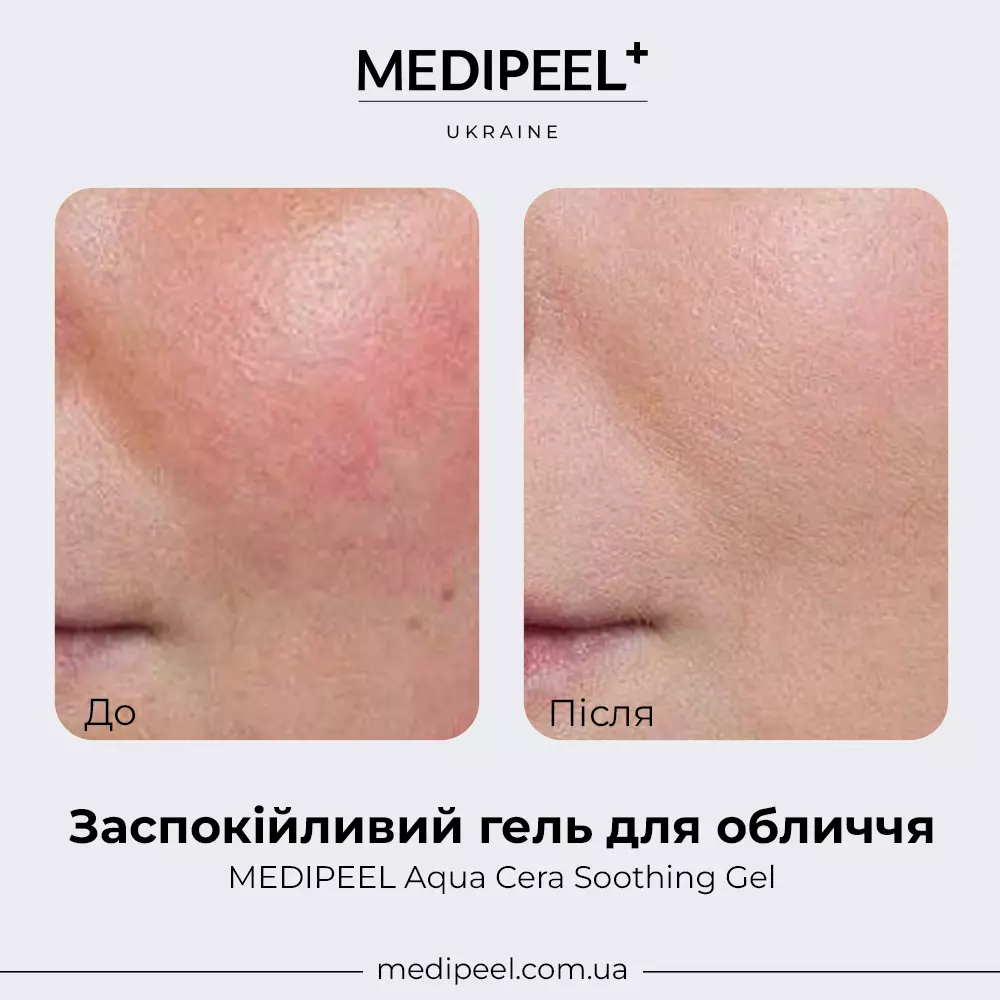 Aqua-Cera-Soothing-Gel.webp