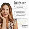 MEDI-PEEL Pepti-Tox Ampoule