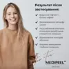 Medi Peel Peptide-Tox Bor Set (Bor-Tox Peptide Set)