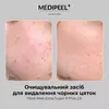 Medi-Peel Extra Super 9 Plus 2.0
