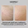 Medi-Peel Extra Super 9 Plus Pore Tox Cleanser