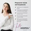 Medi Peel Filler Eazy Ampoule