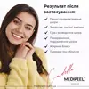 Medi Peel Cindella Multi-Antioxidant Ampoule