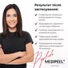 MEDI-PEEL Peptide 9 Volume Tox Cream PRO