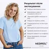 MEDIPEEL Mooltox Glow Moisturizing Modeling Pack