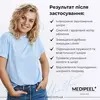 Medi-Peel Hyaluron Layer Mooltox Ampoule