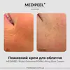 MEDIPEEL Phyto Exosome PDRN Lifting Shot Cream