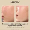 MEDIPEEL Tox-Bor Gold Boosting Mask