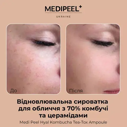 Medi-Peel Hyal Kombucha Tea-Tox Ampoule