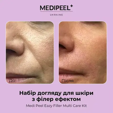 Medi Peel Filler Eazy Multi Care Kit