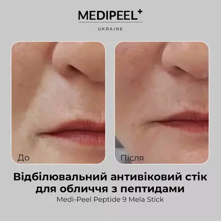 Medi-Peel Peptide 9 Mela Stick