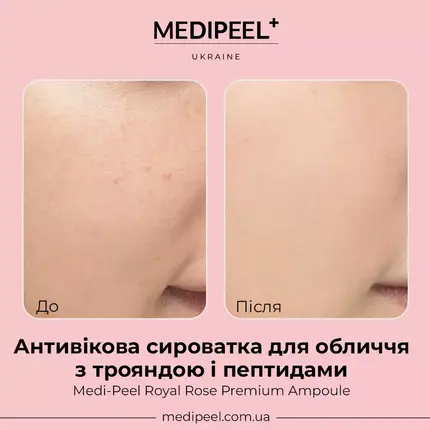 Medi-Peel Royal Rose Premium Ampoule