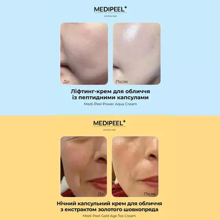 MEDIPEEL Day-Night Capsule Cream