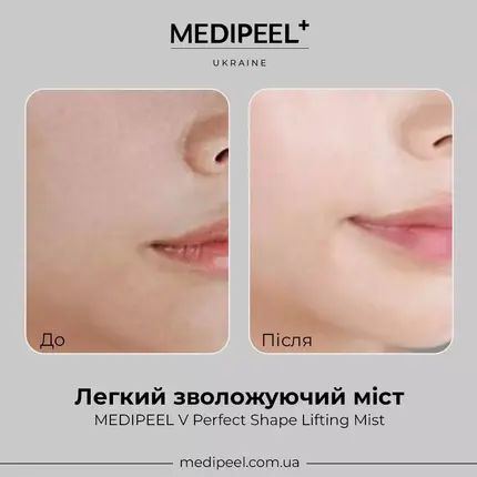 MEDIPEEL V Perfect Shape Lifting Mist