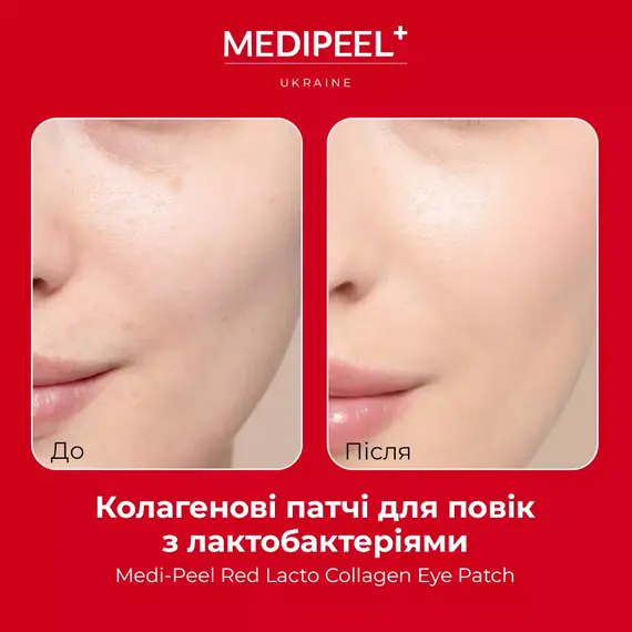 Medi-Peel Red Lacto Collagen Eye Patch