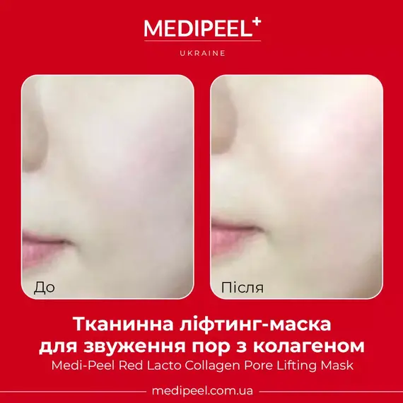 MediPeel Red Lacto Collagen Pore Lifting Mask