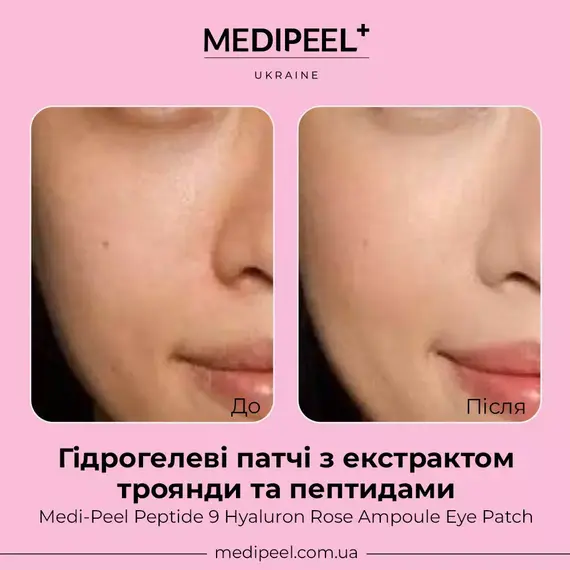 Medi Peel Peptide 9 Hyaluron Rose Ampoule Eye Patch