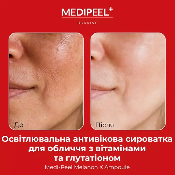 Medi-Peel Melanon X Ampoule