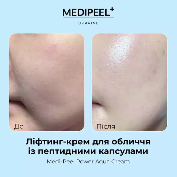 Medi-Peel Power Aqua Cream
