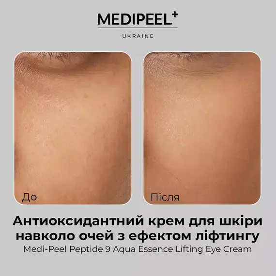 Medi-Peel Peptide 9 Aqua Essence Lifting Eye Cream
