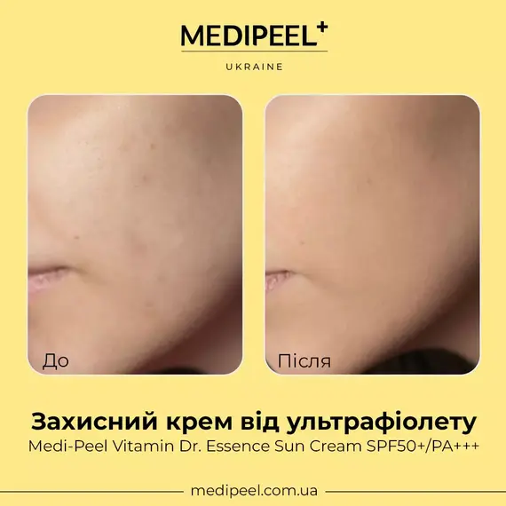Medi Peel Vitamin Dr. Essence Sun Cream SPF50+/PA+++
