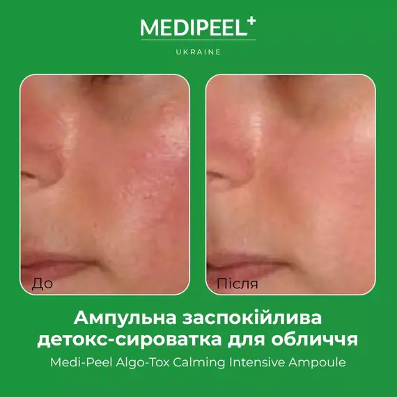 Medi Peel Algo-Tox Calming Intensive Ampoule