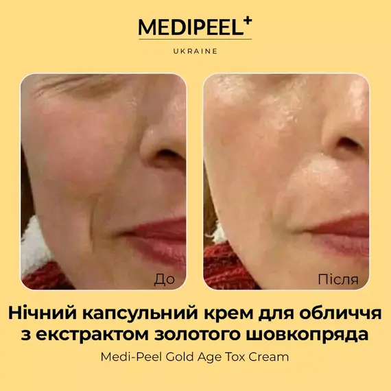 Medi-Peel Gold Age Tox Cream