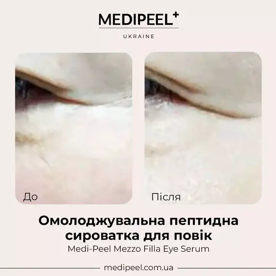 Medi-Peel Mezzo Filla Eye Serum