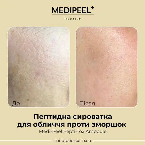 MEDI-PEEL Pepti-Tox Ampoule