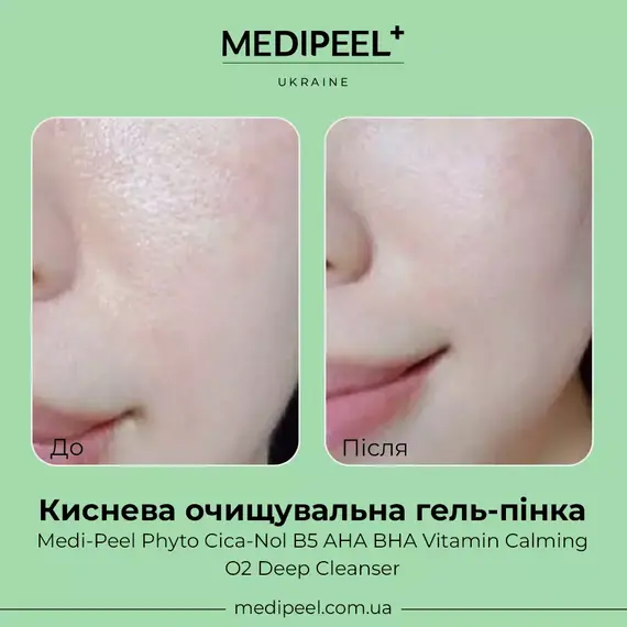 MediPeel Phyto Cica-Nol B5 AHA BHA Vitamin Calming O2 Deep Cleanser